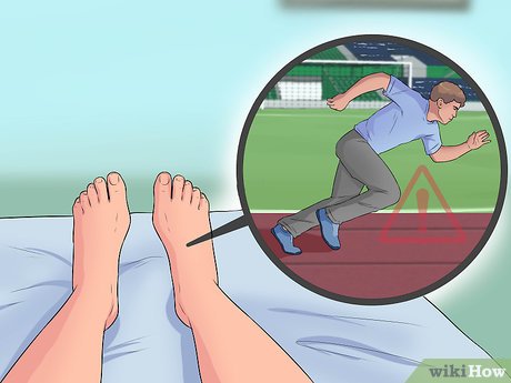 Как лечить плантарный фасциит — wikiHow